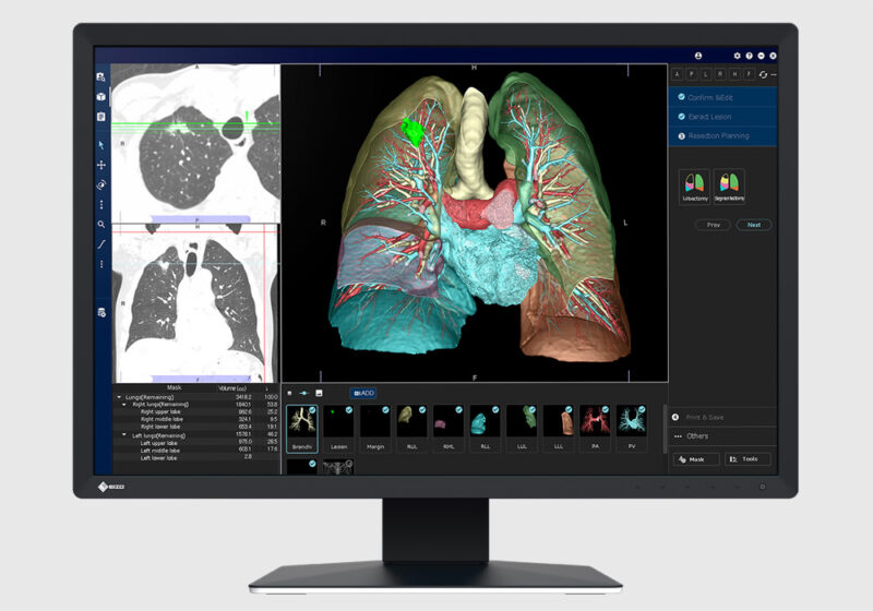 Eizo Radiforce Mx243w Front